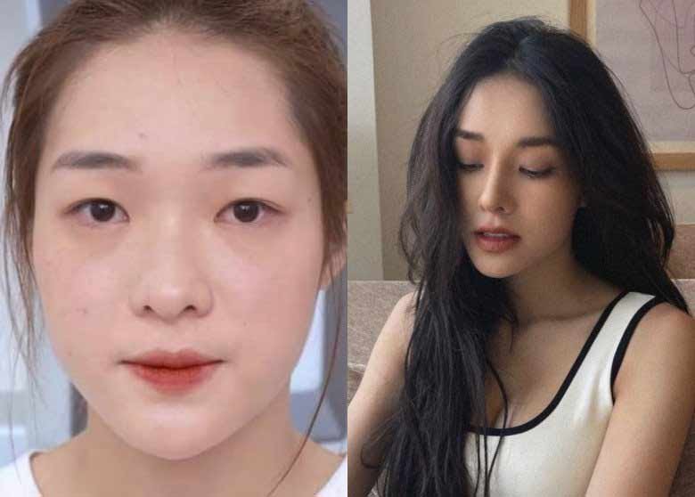 2 người đẹp Nam Định, Thái Bình một bước hóa mỹ nhân nhờ can thiệp dao kéo - 6
