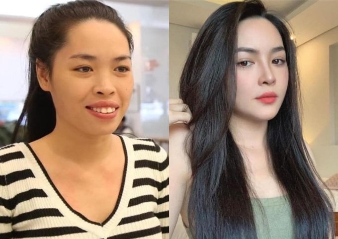 2 người đẹp Nam Định, Thái Bình một bước hóa mỹ nhân nhờ can thiệp dao kéo - 1