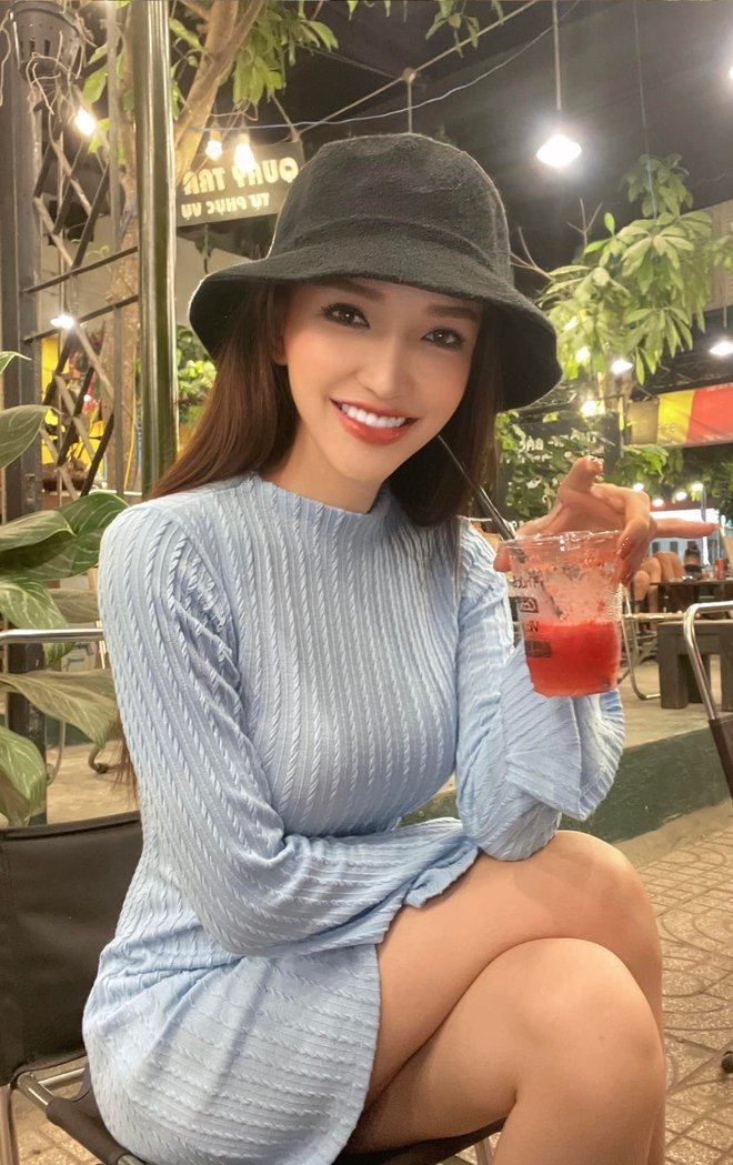 Phẫu thuật 10 lần, chàng trai Đồng Nai “hóa” mỹ nhân, bố mẹ mở lòng đón nhận sau thời gian nghĩ con bị tâm thần - Ảnh 3.