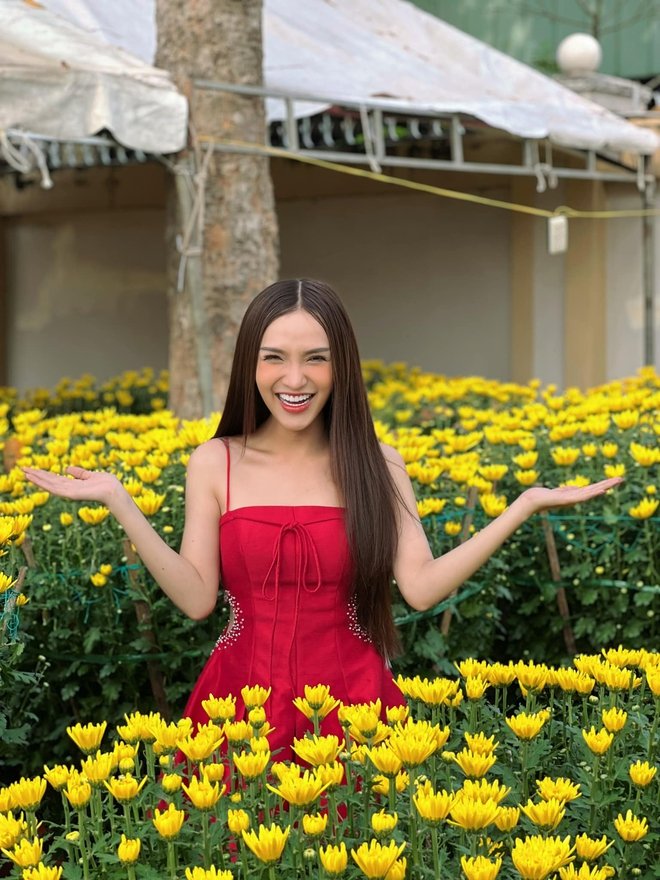 Phẫu thuật 10 lần, chàng trai Đồng Nai “hóa” mỹ nhân, bố mẹ mở lòng đón nhận sau thời gian nghĩ con bị tâm thần - Ảnh 3.