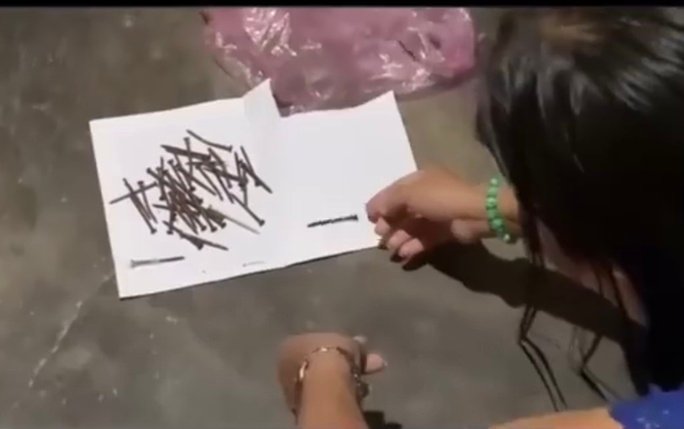 Thông tin một phụ nữ lấy 40 cây đinh từ vết thương trên cánh tay: Địa phương nắm tình hình - Ảnh 1. Thông tin một phụ nữ lấy 40 cây đinh từ vết thương trên cánh tay: Địa phương nắm tình hình - Ảnh 1.