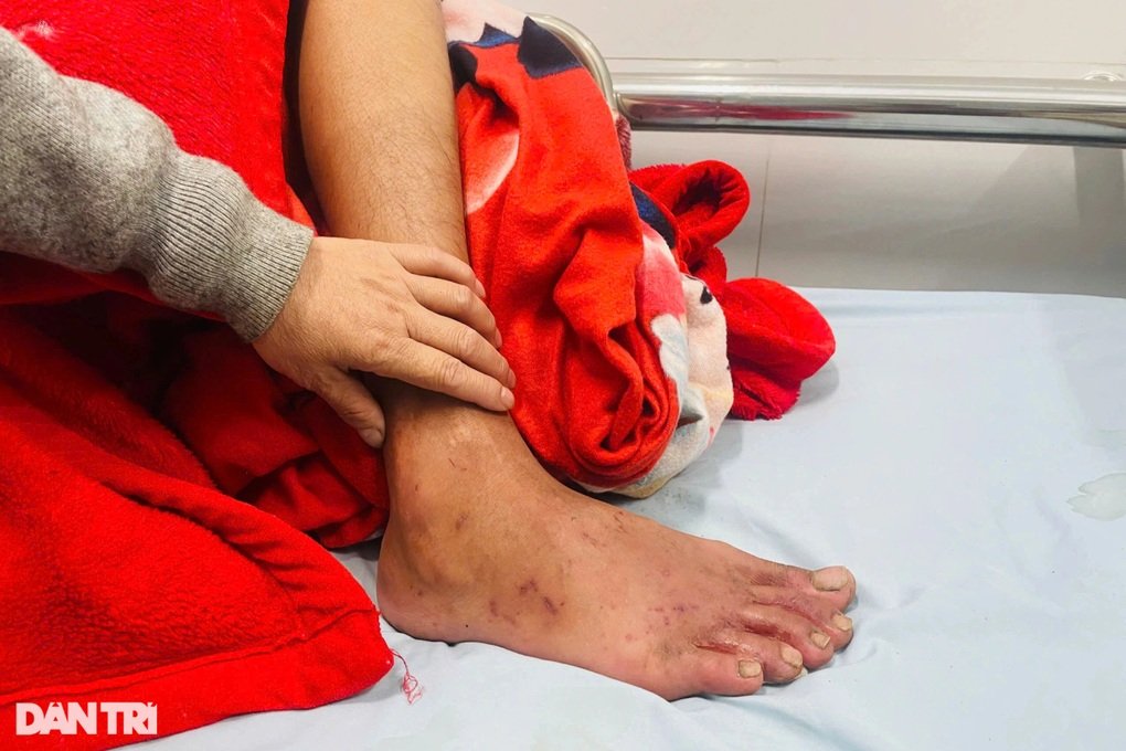 Thanh niên mắc kẹt giữa sông suốt 9 ngày: Đi xem câu cá rồi ngủ quên - 2 Thanh niên mắc kẹt giữa sông suốt 9 ngày: Đi xem câu cá rồi ngủ quên - 2