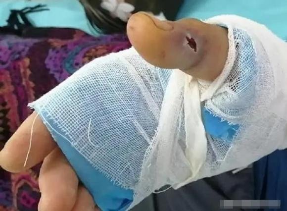 ruou-ran-ngam (1).jpg 3 rượu rắn, rắn ngâm rượu