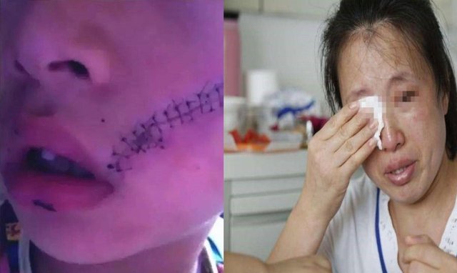 Cậu bé bị khâu 38 mũi do tủ lạnh bất ngờ phát nổ vì thói quen đặt đồ vật này vào tủ lạnh: Cảnh báo, không muốn hiểm họa xảy ra đừng đặt những thứ này vào tủ lạnh - Ảnh 1. Cậu bé bị khâu 38 mũi do tủ lạnh bất ngờ phát nổ vì thói quen đặt đồ vật này vào tủ lạnh: Cảnh báo, không muốn hiểm họa xảy ra đừng đặt những thứ này vào tủ lạnh - Ảnh 1.