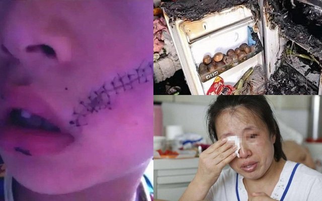 Cậu bé phải khâu 38 mũi do tủ lạnh bất ngờ phát nổ: Cảnh báo, không muốn hiểm họa xảy ra đừng đặt những thứ này vào ngăn đá Cậu bé phải khâu 38 mũi do tủ lạnh bất ngờ phát nổ: Cảnh báo, không muốn hiểm họa xảy ra đừng đặt những thứ này vào ngăn đá